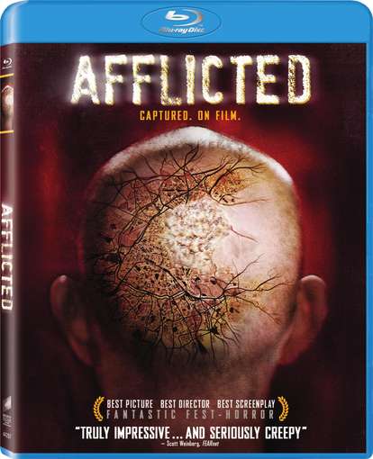AFFLICTED / (UVDC AC3 DOL WS)-AFFLICTED / (UVDC AC3 DOL WS)