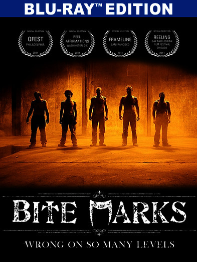 BITE MARKS / (MOD)-BITE MARKS / (MOD)